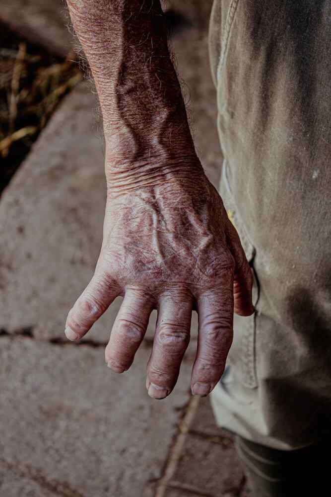 Die Hand von Klaus